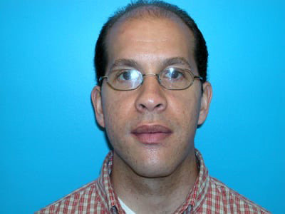 Jaw Surgery Real Patient Results by Dr. Scott Urban in Salt Lake City, Utah