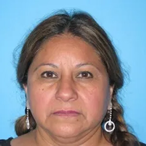 Beautify-Life Lift Real Patient Results by Dr. Scott Urban in Salt Lake City, Utah