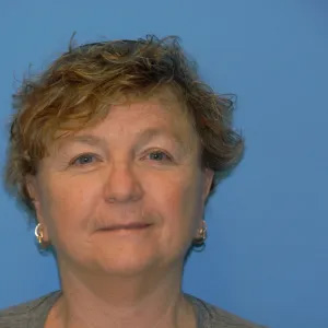 Beautify-Life Lift Real Patient Results by Dr. Scott Urban in Salt Lake City, Utah