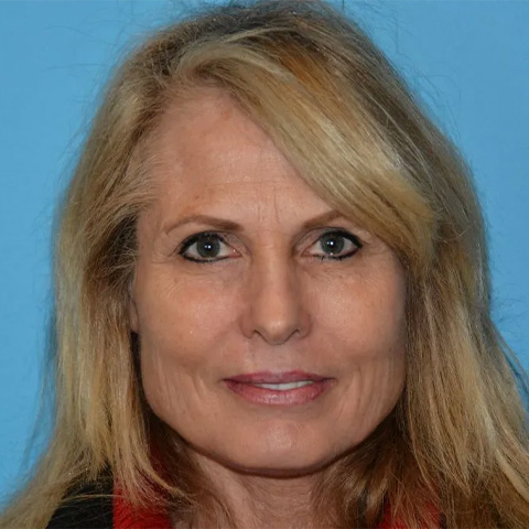 Beautify-Life Lift Real Patient Results by Dr. Scott Urban in Salt Lake City, Utah