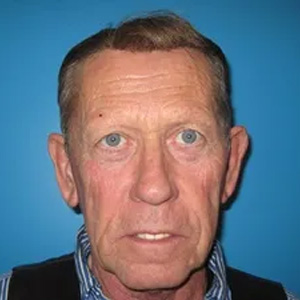 Beautify-Life Lift Real Patient Results by Dr. Scott Urban in Salt Lake City, Utah