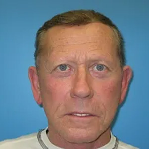 Beautify-Life Lift Real Patient Results by Dr. Scott Urban in Salt Lake City, Utah