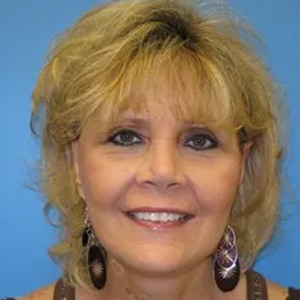 Beautify-Life Lift Real Patient Results by Dr. Scott Urban in Salt Lake City, Utah