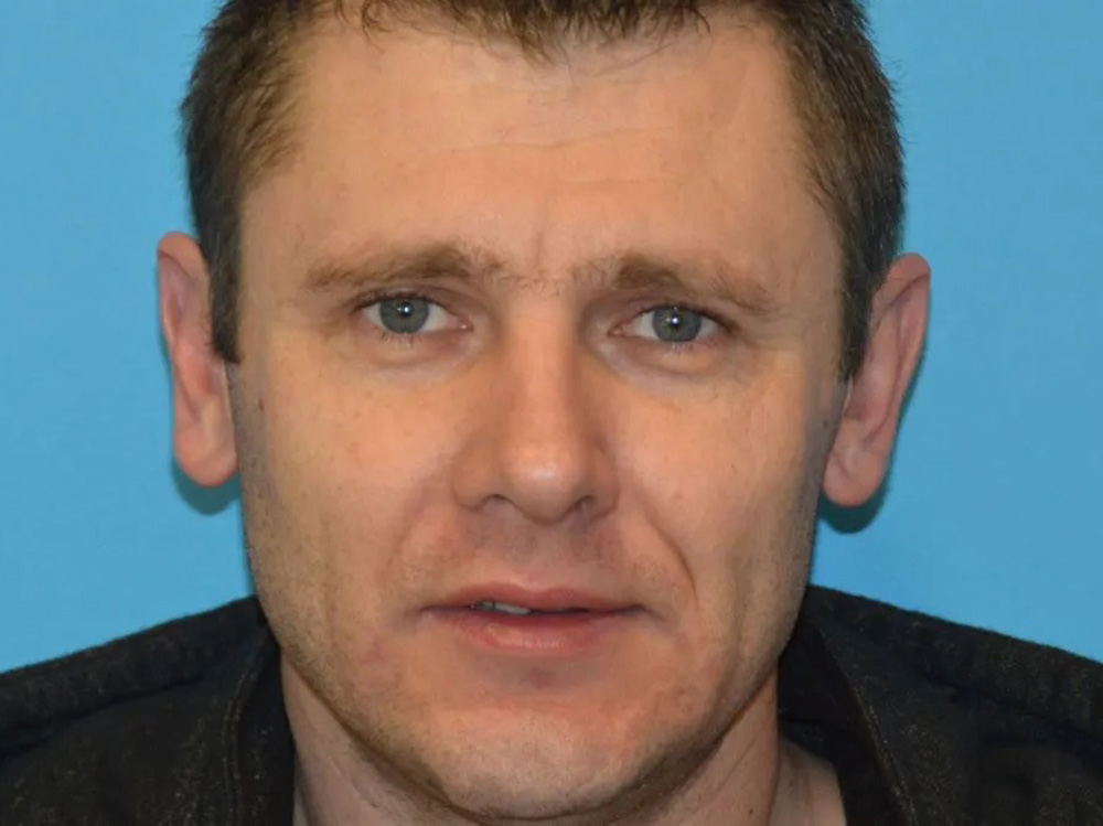 Cheek Implants Real Patient Results by Dr. Scott Urban in Salt Lake City, Utah