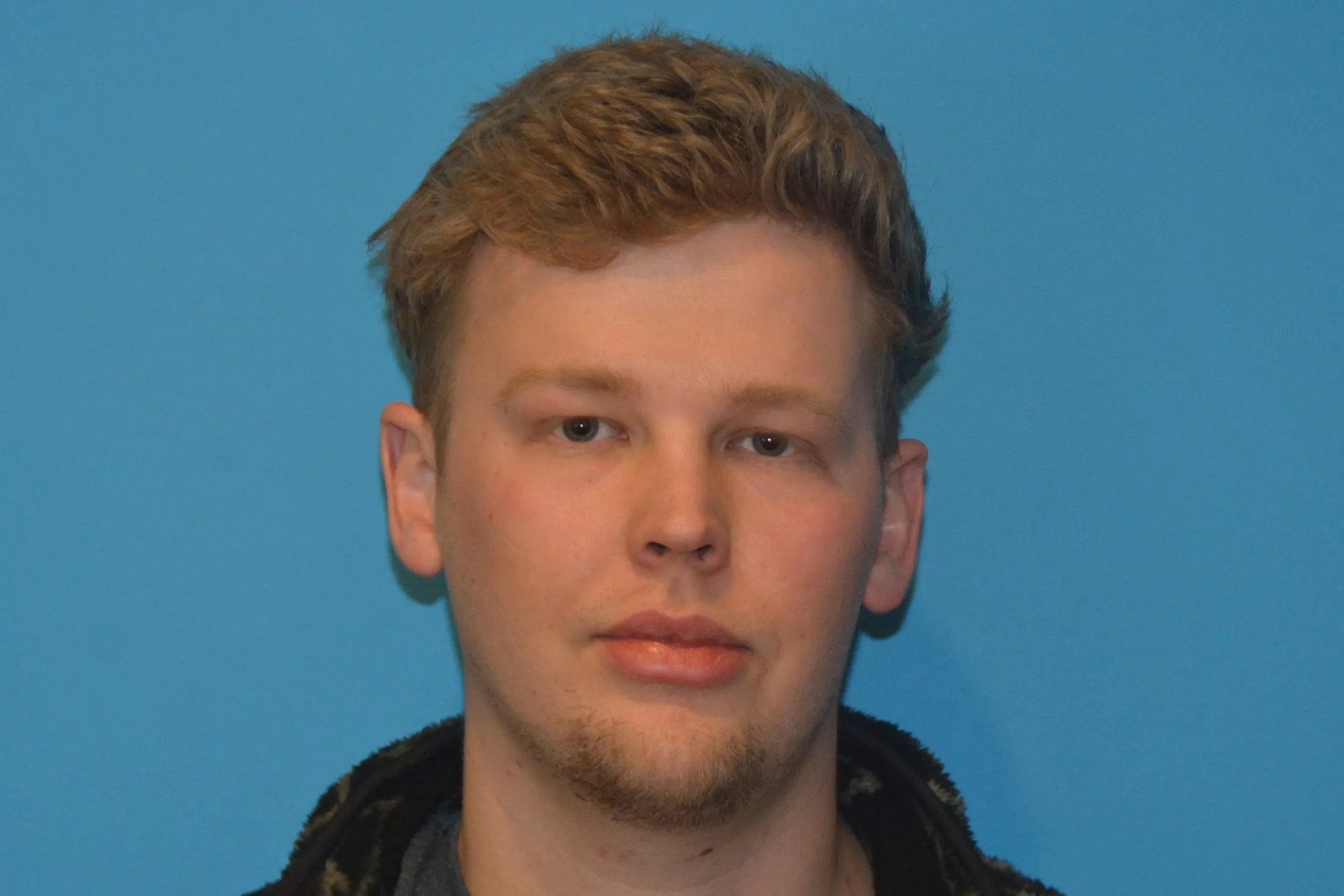 Chin Implants Real Patient Results by Dr. Scott Urban in Salt Lake City, Utah