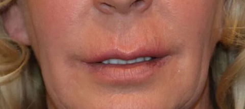 len1